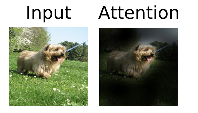 Attention